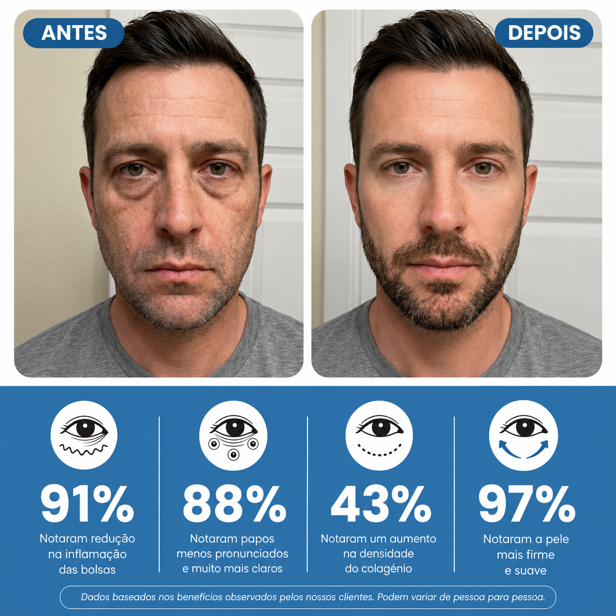 Óculos anti bolsas e olhos