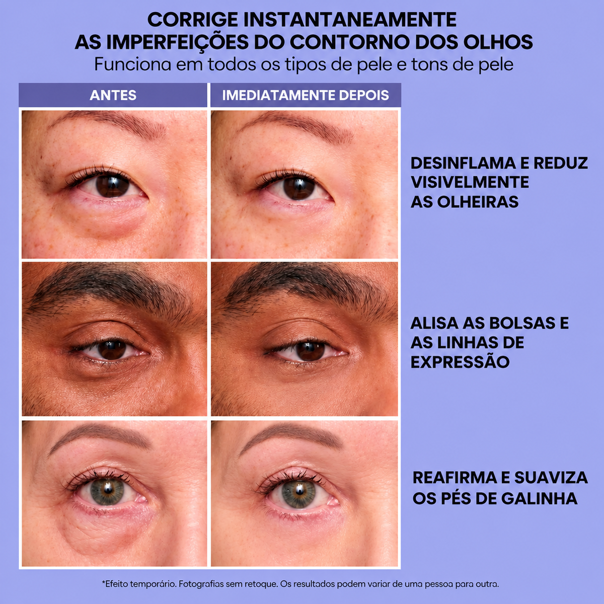 InfiniteLift – Gel lifting para bolsas e linhas de expressão