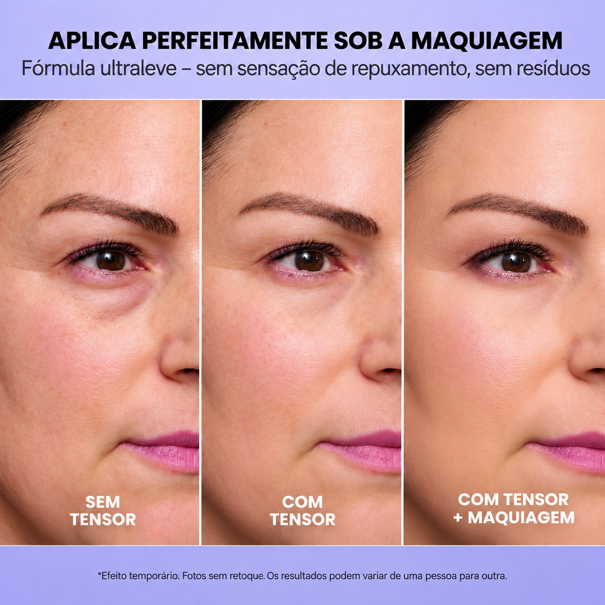 InfiniteLift – Gel lifting para bolsas e linhas de expressão