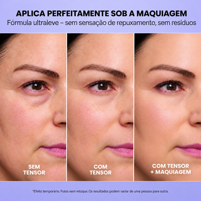 InfiniteLift – Gel lifting para bolsas e linhas de expressão