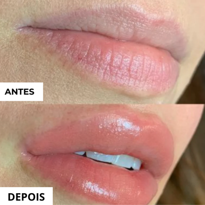 Voluminizador de Lábios GLUMI