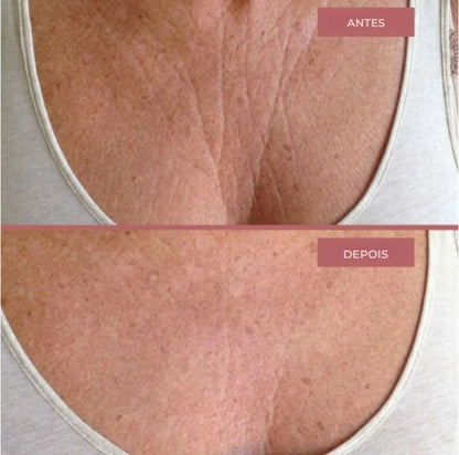 Patches de biocolágeno para o peito