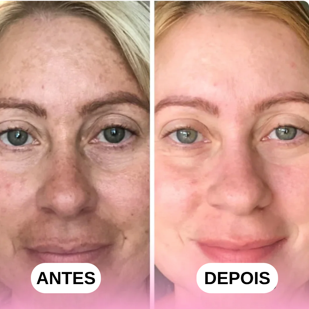 Discos de Cúrcuma e Ácido Kójico