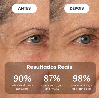 Creme antirrugas com veneno de abelha