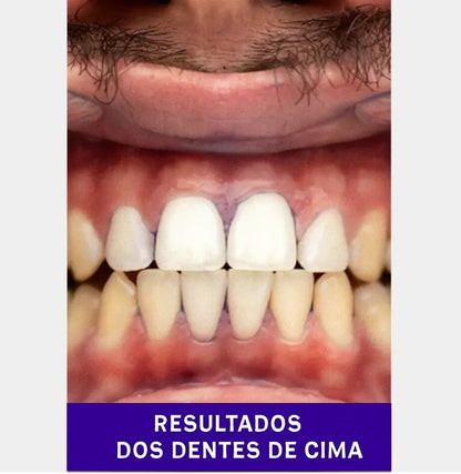 Tiras Branqueadoras V34