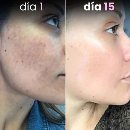 Discos de Cúrcuma e Ácido Kójico