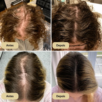 Tratamento com óleo natural para o crescimento do cabelo