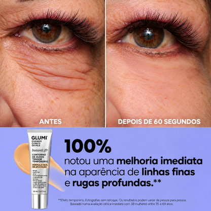 InfiniteLift – Gel lifting para bolsas e linhas de expressão
