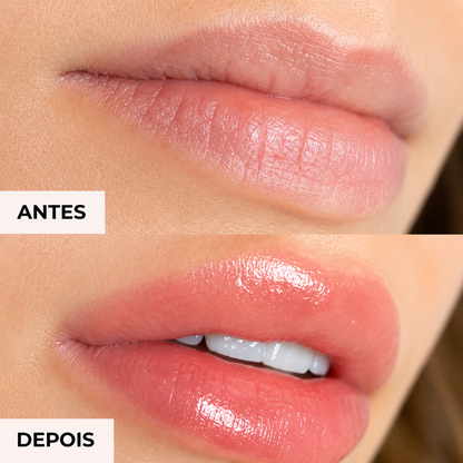 Volumizador de lábios GLUMI