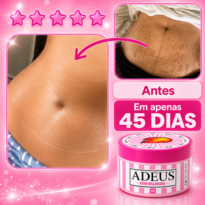 Creme Rosa Adeus – contra as estrias e a celulite