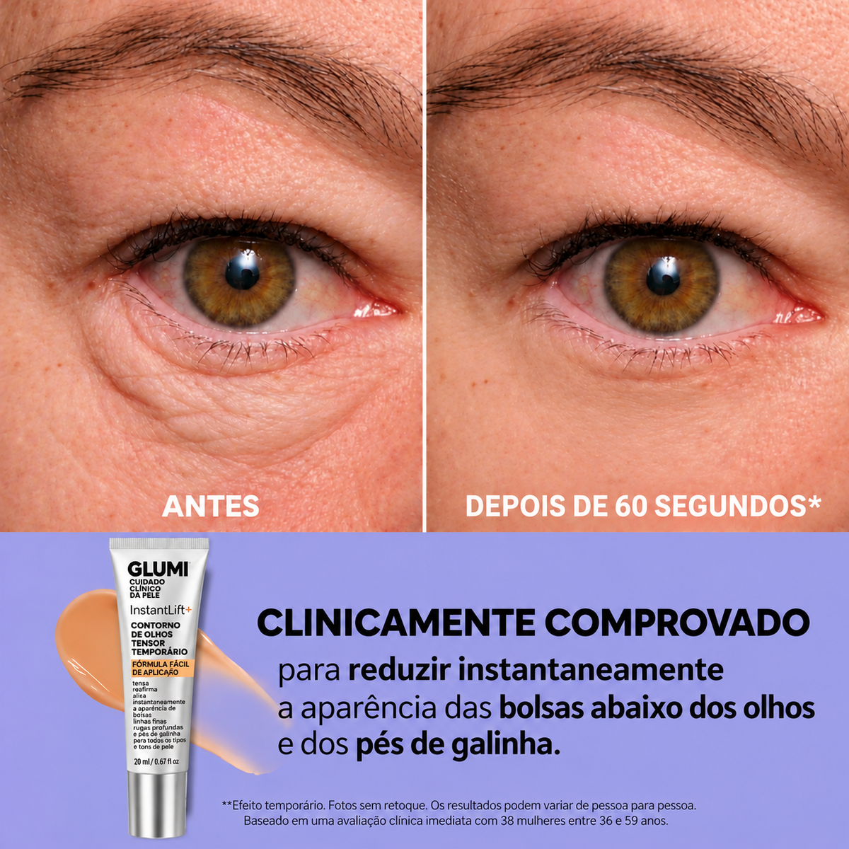 InfiniteLift – Gel lifting para bolsas e linhas de expressão